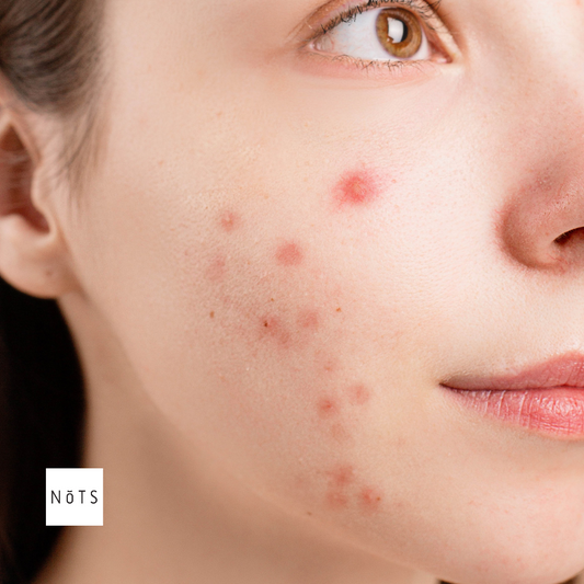Best Scar Cream: The Essential Guide to Top Scar Treatments