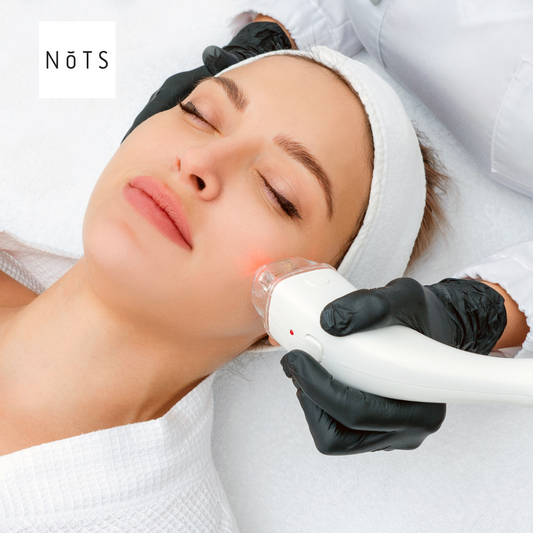 Why some acne scars never fade—and what to do about it.