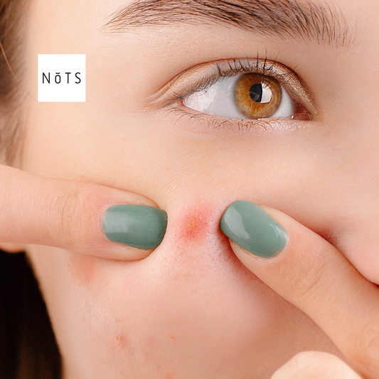 Discover the Best Scar Cream: Why NOTS Centella Scar Ointment is a Top Scar Treatment